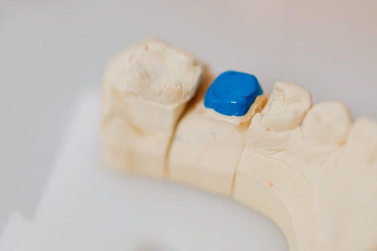 Quels sont les risques des troubles de l’occlusion dentaire ? – Les Bons Reflexes