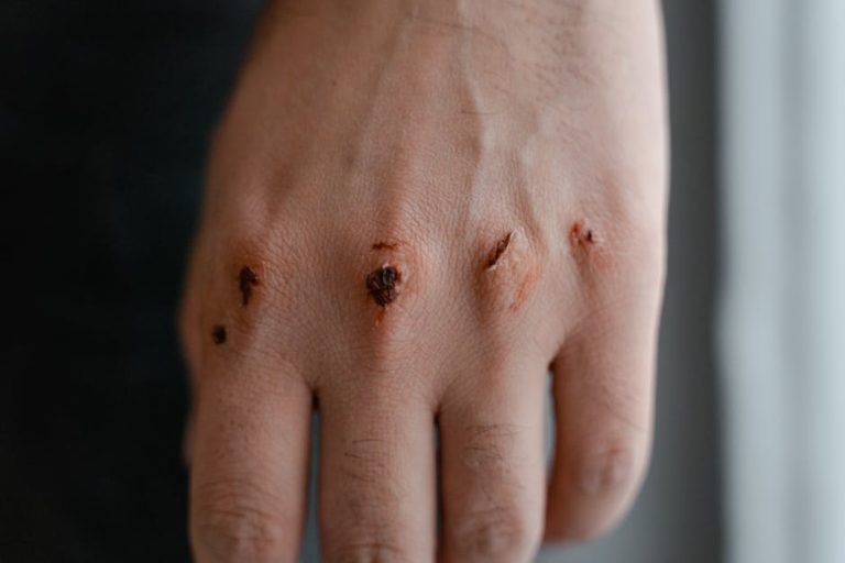 Comment enlever un pansement dentaire en toute sécurité