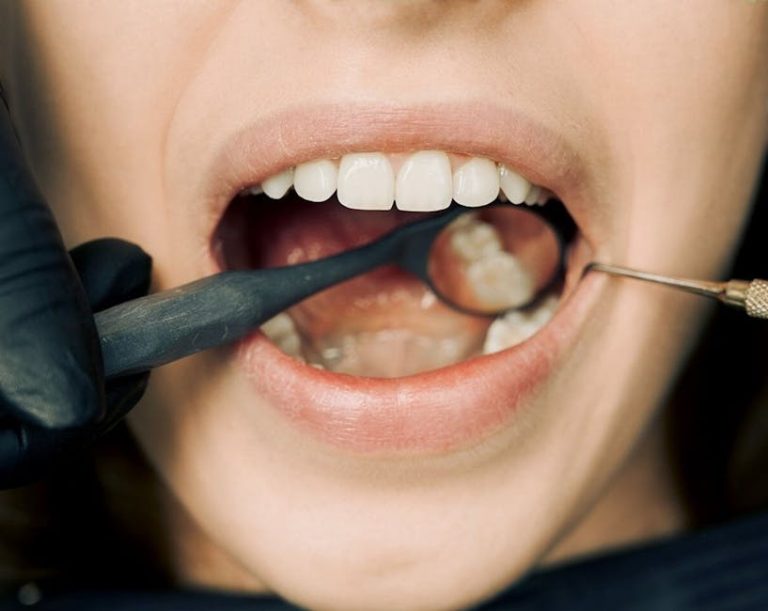Faut-il se brosser les gencives : votre guide pour une bouche saine