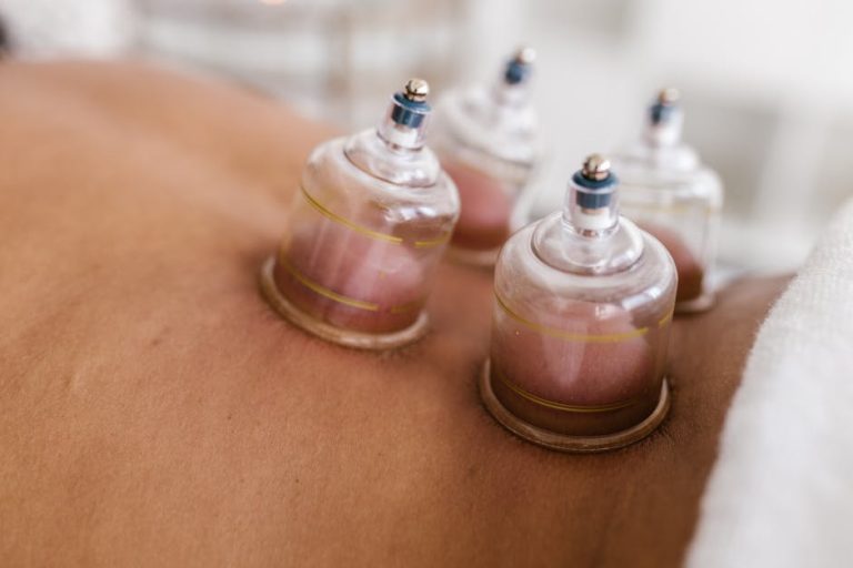 Point acupuncture apnée du sommeil : solutions naturelles pour mieux respirer